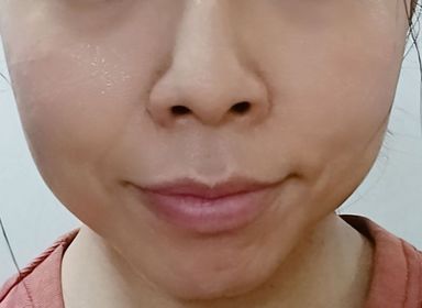mandy-MEDIHEAL積雪草特強修護精華水庫面膜_3