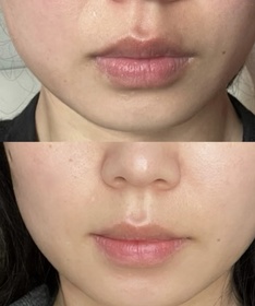 YYeman-OLAYPROX 淡紋屏障修護黑管面霜_1