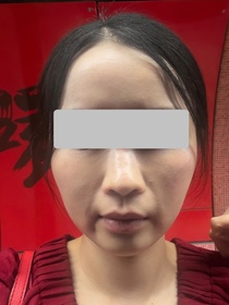 Judy-L'ORÉAL PARiS金致臻顏花蜜奢養膠原輕盈乳霜_2