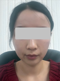 Judy-L'ORÉAL PARiS金致臻顏花蜜奢養膠原輕盈乳霜_3