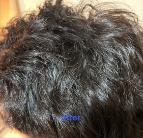 吖笨-Head & Shoulders水油平衡洗頭水（蓬鬆豐盈型）_4