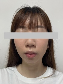 　peg-Charlotte Tilbury輕盈無瑕柔光蜜粉 #磨皮銀餅_2