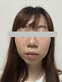 　peg-Charlotte Tilbury輕盈無瑕柔光蜜粉 #磨皮銀餅_3