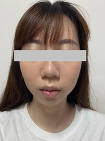 　peg-Charlotte Tilbury輕盈無瑕柔光蜜粉 #磨皮銀餅_4