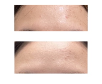 chasiutung-L'ORÉAL PARiS金致臻顏花蜜奢養膠原輕盈乳霜_2