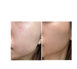 chasiutung-L'ORÉAL PARiS金致臻顏花蜜奢養膠原輕盈乳霜_3