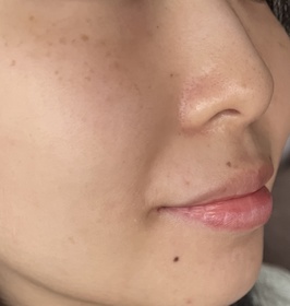 yingtang1999-L'ORÉAL PARiS金致臻顏花蜜奢養膠原輕盈乳霜_3
