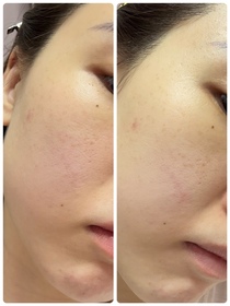 Eun H-Physiogel 逆齡抗氧精華面膜_3