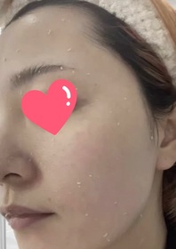 Fng-The Body Shop植物幹細胞活肌去角質啫喱_1