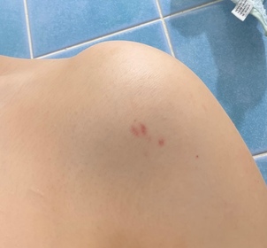 Candy Ng-YHKcareTeaPep黑茶肽修護潤膚乳_2