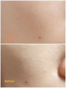Hellobeauty -OLAYPROX 淡紋屏障修護黑管面霜_3