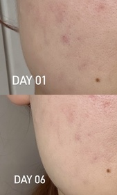 迪迪-SHISEIDO 資生堂ULTIMUNE皇牌免疫力活膚精華_1