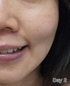 helloapap-OLAYPROX 淡紋屏障修護黑管面霜_2