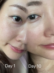 Avob-SHISEIDO 資生堂ULTIMUNE皇牌免疫力活膚精華_3