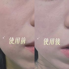 Tung Yi-SHISEIDO 資生堂養膚修護精華蜜粉 _2