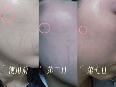 Tung Yi-SHISEIDO 資生堂ULTIMUNE皇牌免疫力活膚精華_1