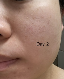 BubuJessie-OLAYPROX 淡紋屏障修護黑管面霜_3