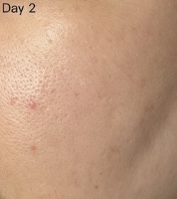 CLS24-SHISEIDO 資生堂ULTIMUNE皇牌免疫力活膚精華_3