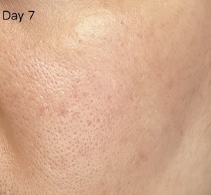 CLS24-SHISEIDO 資生堂ULTIMUNE皇牌免疫力活膚精華_4