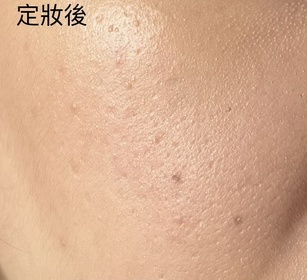 CLS24-SHISEIDO 資生堂養膚修護精華蜜粉 _4