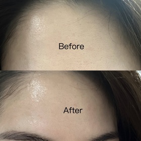 Cherly_ch-SHISEIDO 資生堂ULTIMUNE皇牌免疫力活膚精華_4