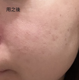 oy -SHISEIDO 資生堂養膚修護精華蜜粉 _1
