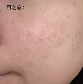 oy -SHISEIDO 資生堂養膚修護精華蜜粉 _2