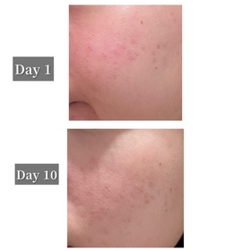 oy -SHISEIDO 資生堂ULTIMUNE皇牌免疫力活膚精華_2