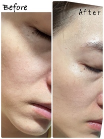 Rin-SHISEIDO 資生堂ULTIMUNE皇牌免疫力活膚精華_3