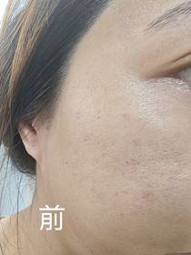 Erica -YVES ROCHER花萃幹細胞再生煥肌水_2