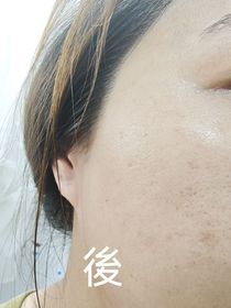 Erica -YVES ROCHER花萃幹細胞再生煥肌水_3