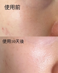 Maggie Wong-KOSE 雪肌精雪肌精 BLUE 水潤透亮防曬精華_4