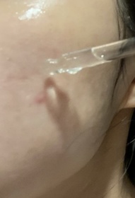 Emily Leung-DR.WU杏仁酸溫和煥膚精華8% _3