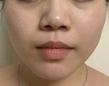 Emma W-MEDIPEEL胺基酸膠原毛孔提拉面膜_2