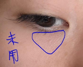EC-AHC醫美逆齡活膚全面眼霜_1