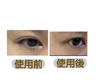 chasiutung-AHC醫美逆齡活膚全面眼霜_1