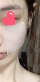Fng-Dermacept幹細胞緊緻化妝水 (第2代)_2