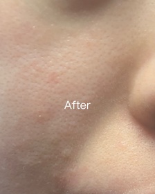 Emma-INNISFREE超級火山泥毛孔清潔面膜_2