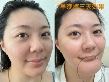Elaine-L'ORÉAL PARiS超水光精華_2