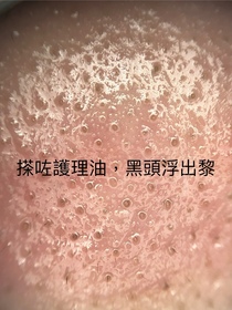 Emma-DECORTÉAQ 溶解黑頭毛孔護理油_2