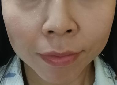 mandy-iskinclock維C煥白臻萃面膜_3