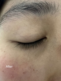Jo-CLARINS賦活雙萃精華眼霜_4