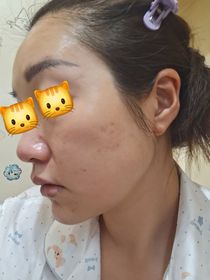 wookayee02150-SHISEIDO 資生堂ULTIMUNE皇牌免疫力活膚精華_3