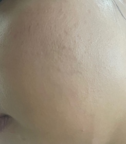 琉光星辰-SHISEIDO 資生堂ULTIMUNE皇牌免疫力活膚精華_2