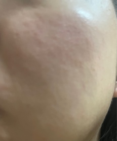 琉光星辰-SHISEIDO 資生堂ULTIMUNE皇牌免疫力活膚精華_3