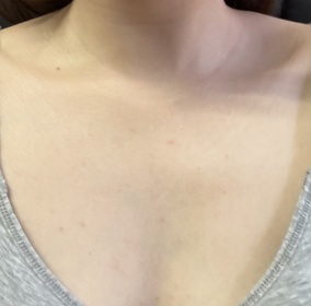 peg-JOSERISTINE 彩豐皮奧寧防痘.身體護理噴霧_2