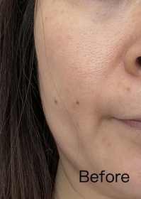 Winnie-L'ORÉAL PARiS超水光精華水_3