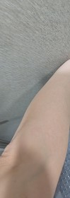 CC-JOSERISTINE 彩豐皮奧寧防痘.身體護理噴霧_4