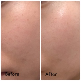 YiN-L'ORÉAL PARiS超水光精華乳_4