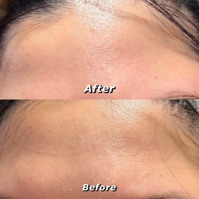 bobobeauty-L'ORÉAL PARiS超水光精華乳_2